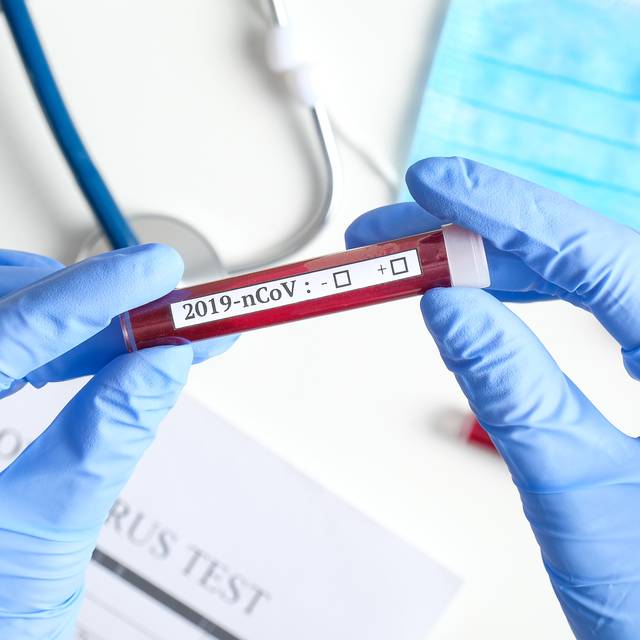 Ein Test für das Krankheitsbild des 2019-nCoV (Symbolbild).