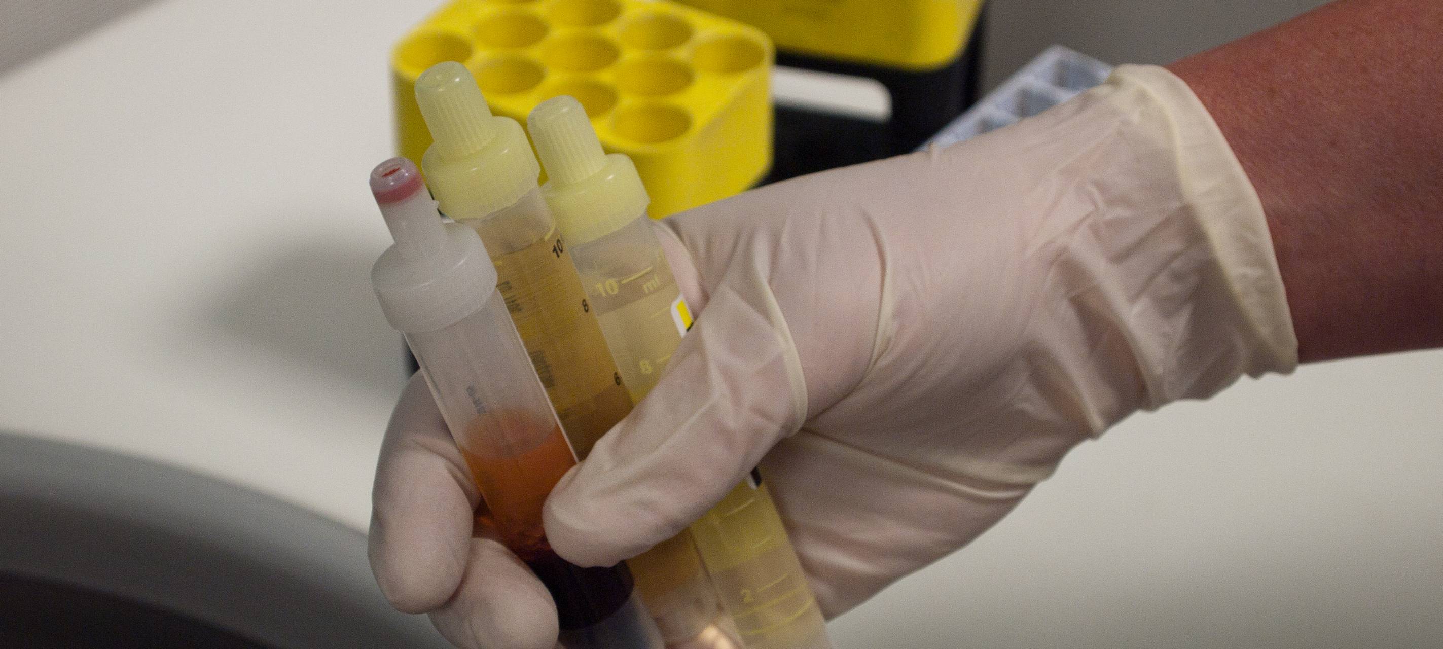 Coronavirus: Zwei Studierende in Quarantäne