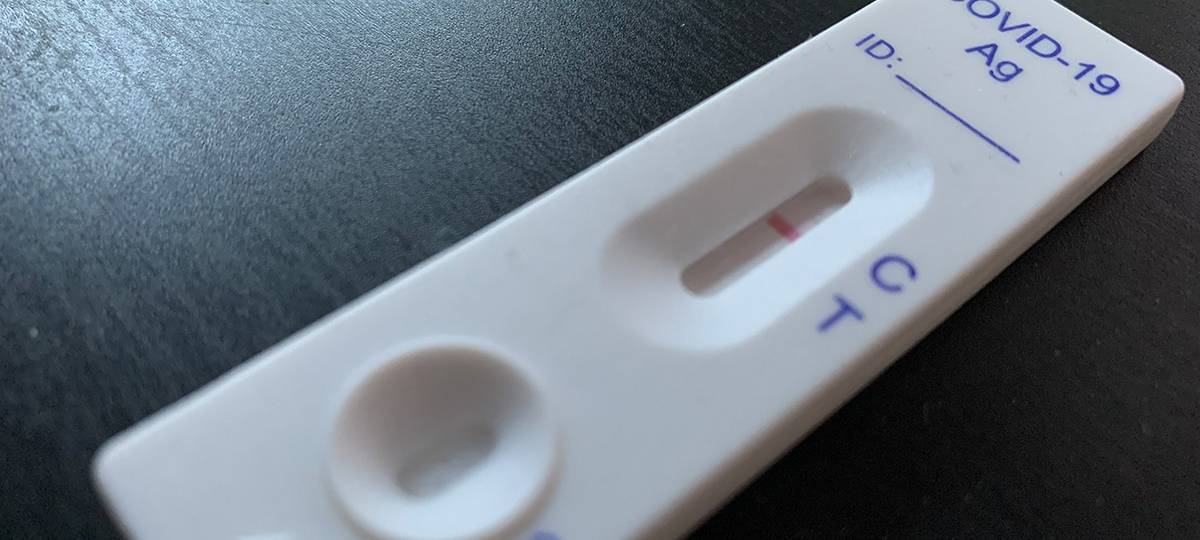Probleme bei Bürgertests: Stadt Duisburg spricht von Einzelfällen