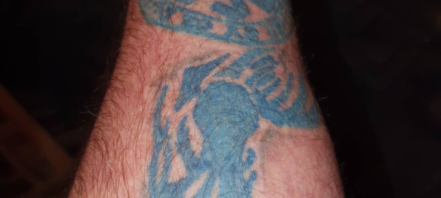 MSV geht unter die Haut