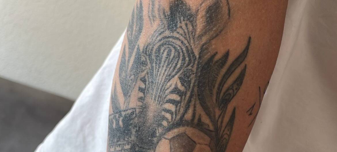 MSV geht unter die Haut