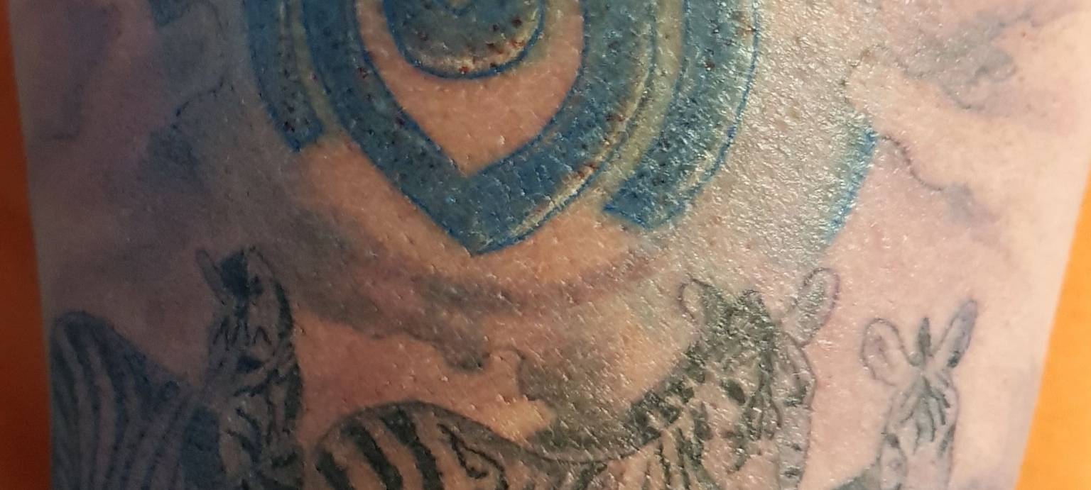 MSV geht unter die Haut